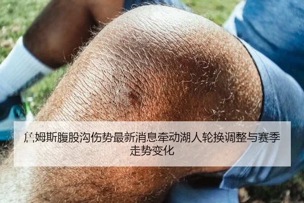 詹姆斯腹股沟伤势最新消息牵动湖人轮换调整与赛季走势变化